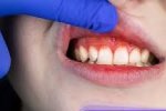 بیماری های دهان و دندان می توانند در بقیه قسمت های بدن ایجاد بیماری کنند
